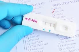 Pemeriksaan Anti HBS